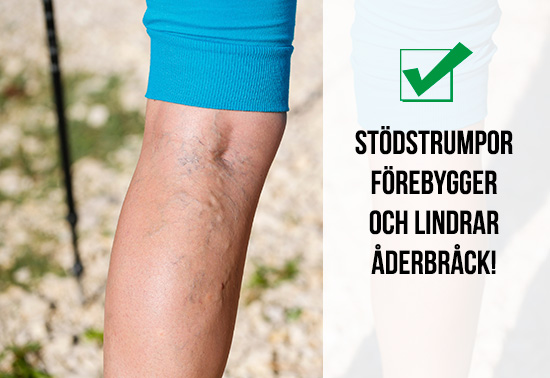 Stödstrumpor lindrar åderbråck